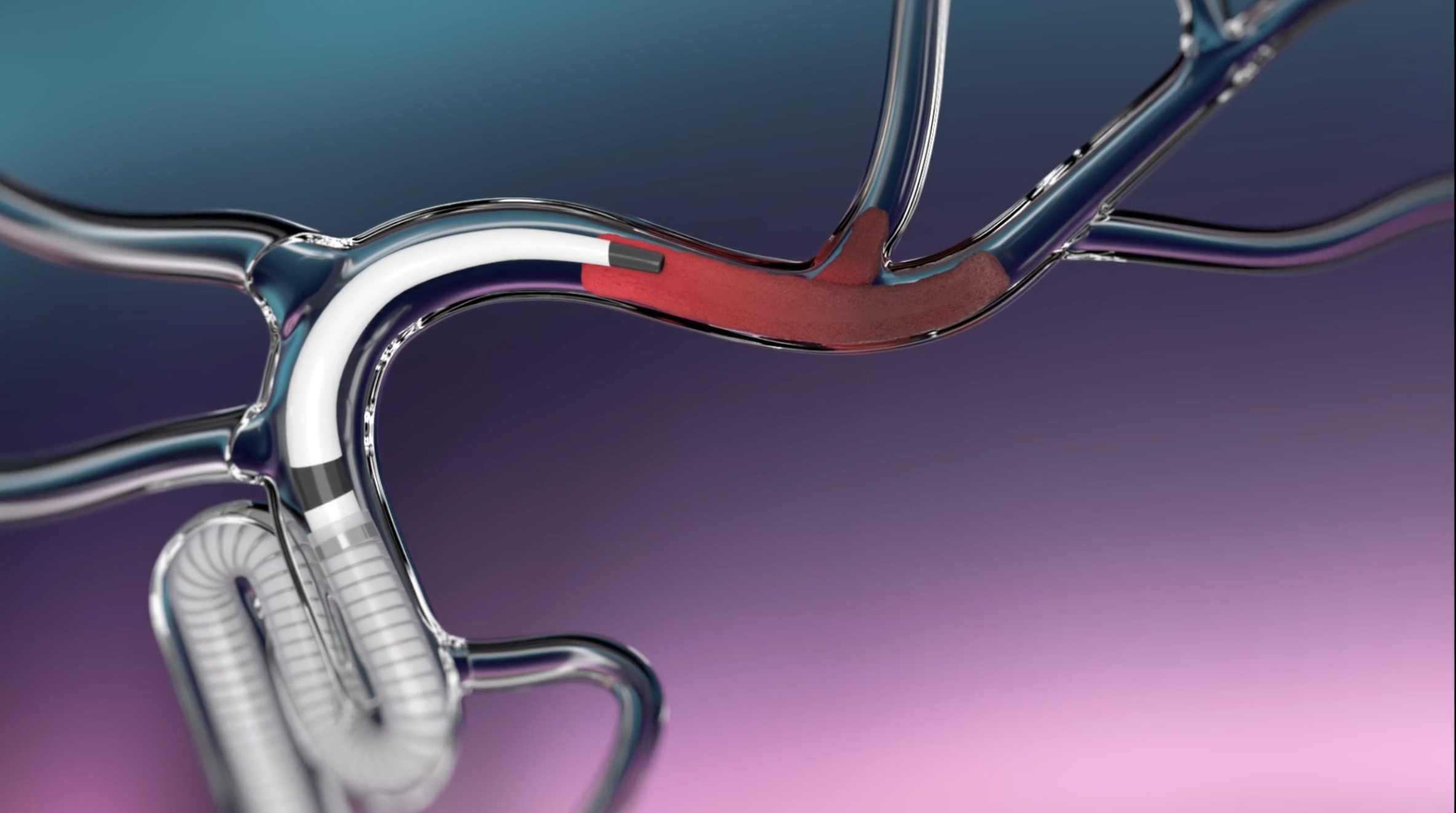 Rendering of the ASCENT catheter engaging a clot within a vessel